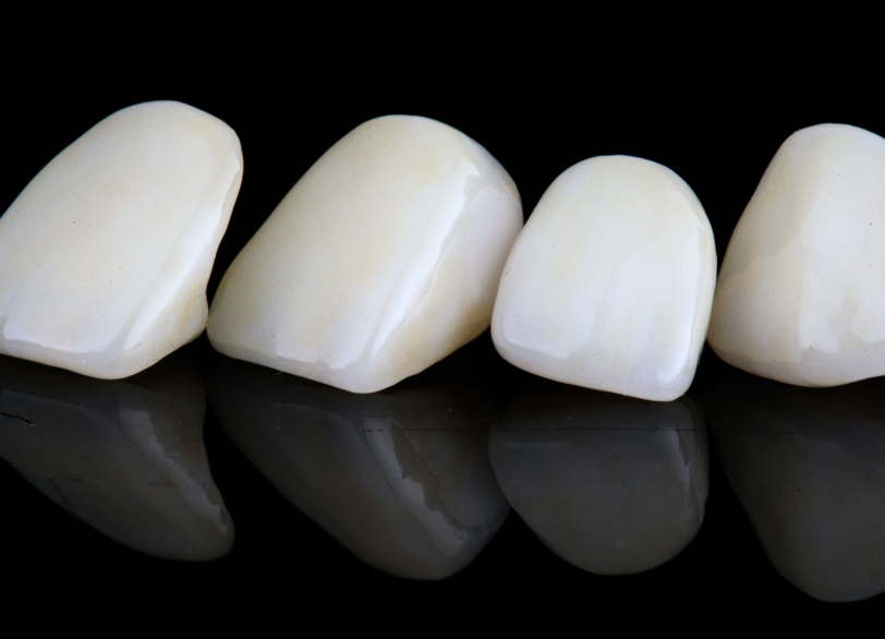 セラミッククラウン|クリア総合歯科