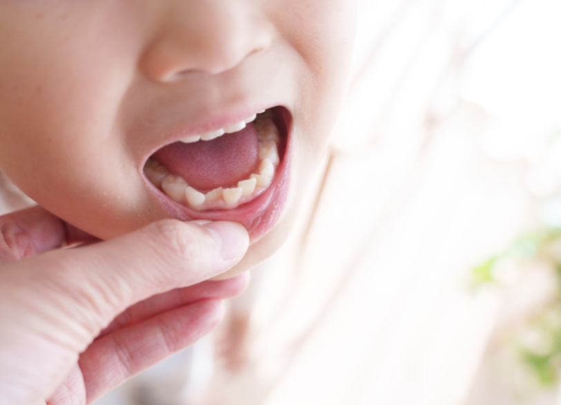 見過ごされがちなお口の重要なサイン｜クリア総合歯科