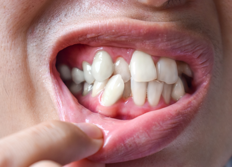 このようなお悩みはありませんか？｜クリア総合歯科