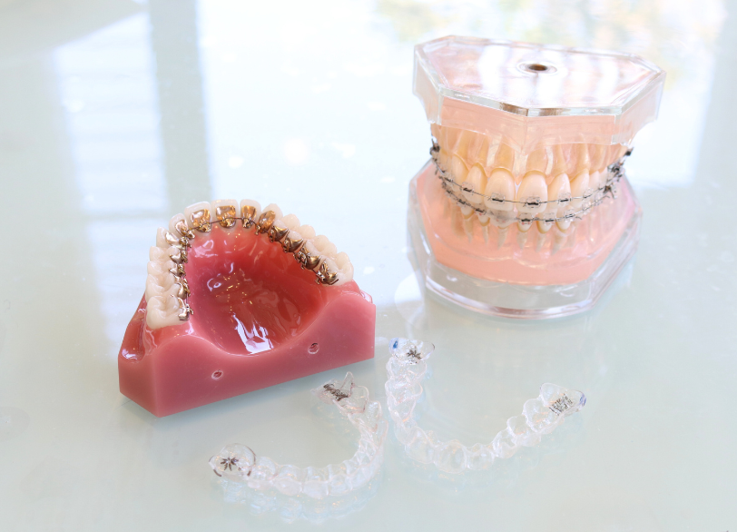 患者様のライフスタイルに寄り添う治療法の選択肢｜クリア総合歯科