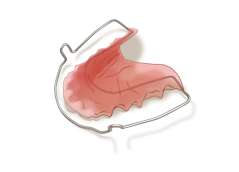 リテーナー｜クリア総合歯科