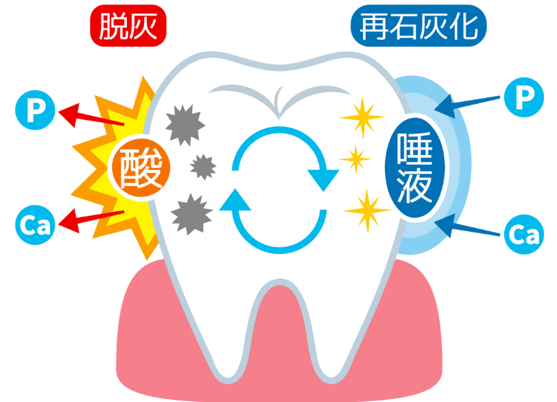 虫歯の原因｜クリア総合歯科