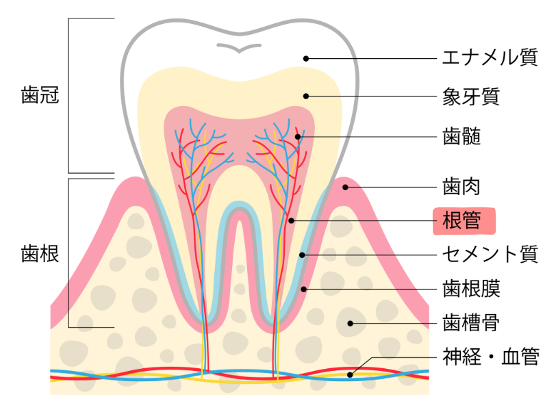 根管治療が難しい理由｜クリア総合歯科