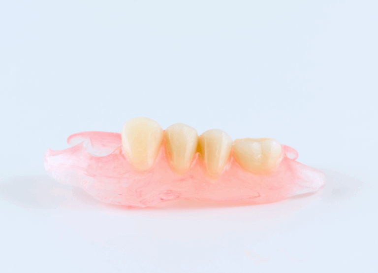 ノンクラスプデンチャー｜クリア総合歯科