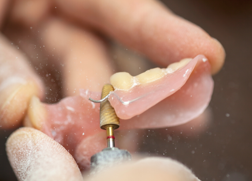 オーダーメイドの製作工程｜クリア総合歯科