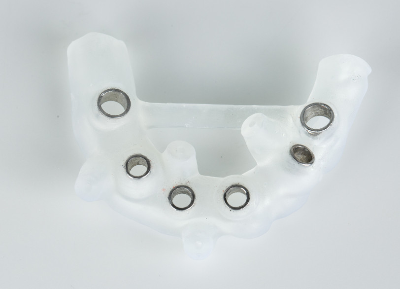 サージカルガイド｜クリア総合歯科