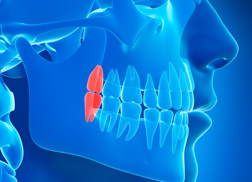 親知らずとは｜クリア総合歯科