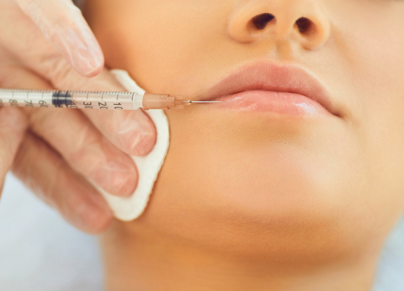 唇のボリュームアップ|クリア総合歯科