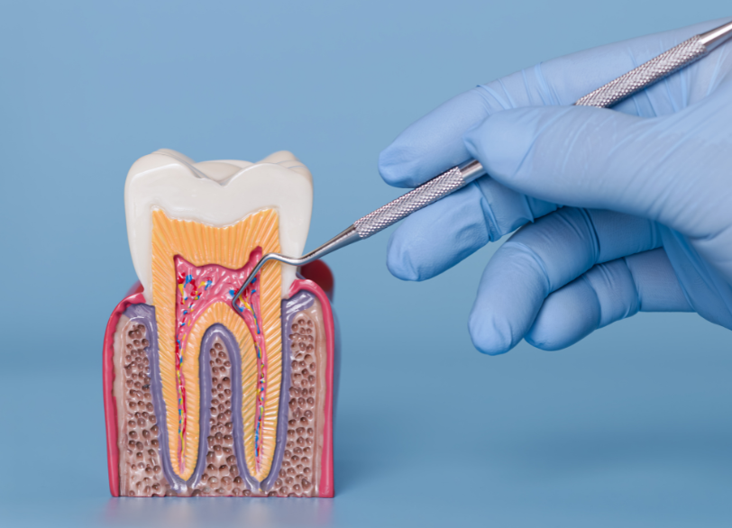 内因性｜クリア総合歯科