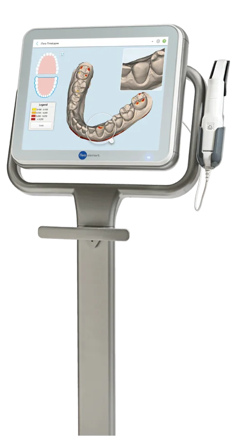 iTero Elementで快適な型取り