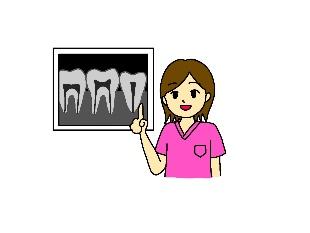 歯のレントゲン写真のイメージ