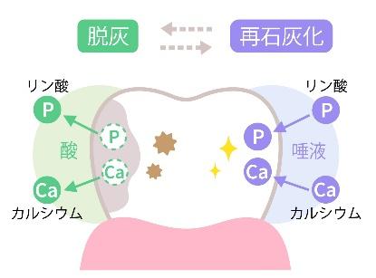 脱灰と再石灰化のイメージ