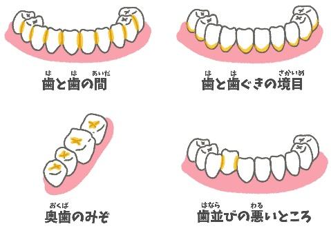 磨き残しの多い場所