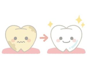 ホワイトニングのビフォーアフター