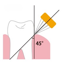 歯に対して45度