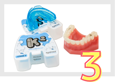 3 歯並びを根本原因から改善する「マイオブレース治療」を採用